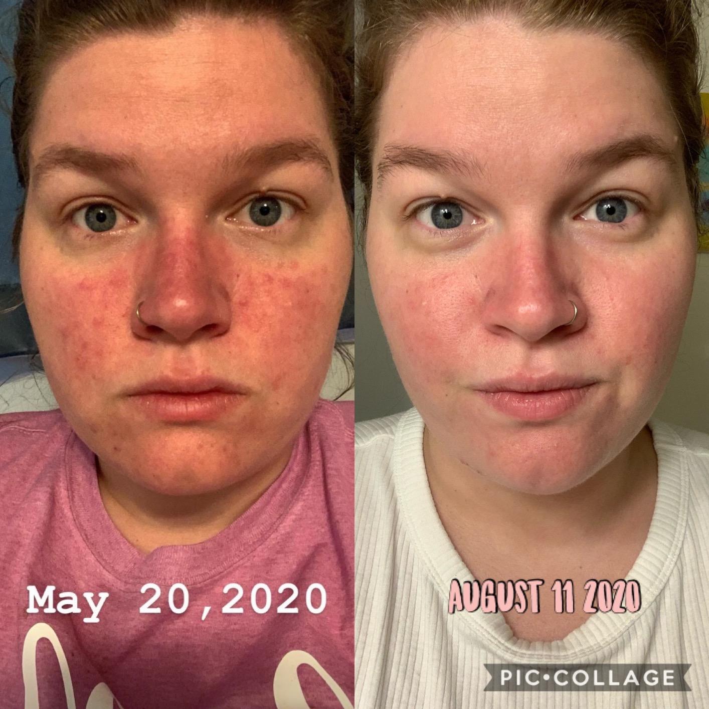 Instant Loss: Eat Real, Lose Weight: How I Lost 125 Pounds―Includes 100+ Recipes customer photo 1
