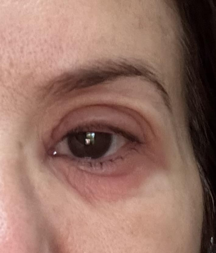 Olay Eyes Ultimate Eye Cream for Dark Circles, Wrinkles and Puffiness, 13 ml (0.4 fl. oz.) customer photo 2