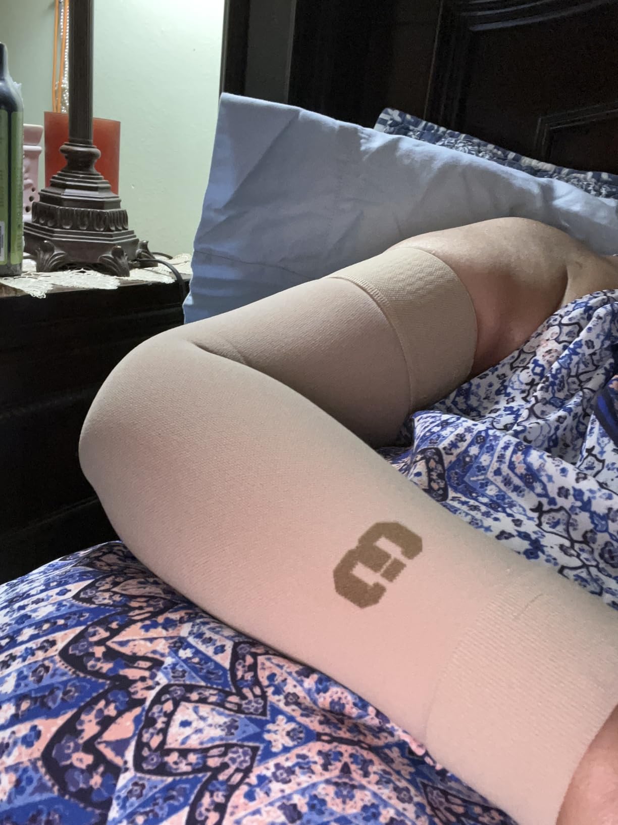 MGANG Medical Compression Arm Sleeve 15-20 mmHg, Lymphedema & Post-Surgery customer photo 1