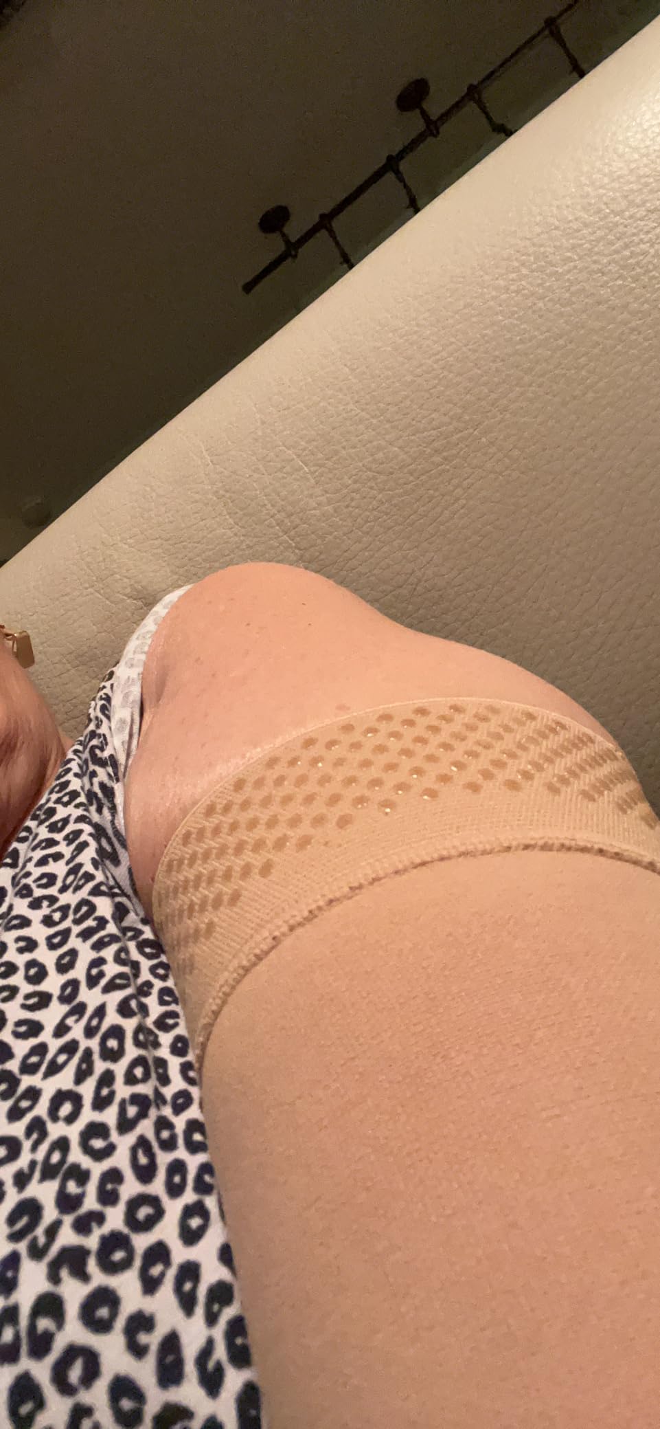 MGANG Medical Compression Arm Sleeve 15-20 mmHg, Lymphedema & Post-Surgery customer photo 2