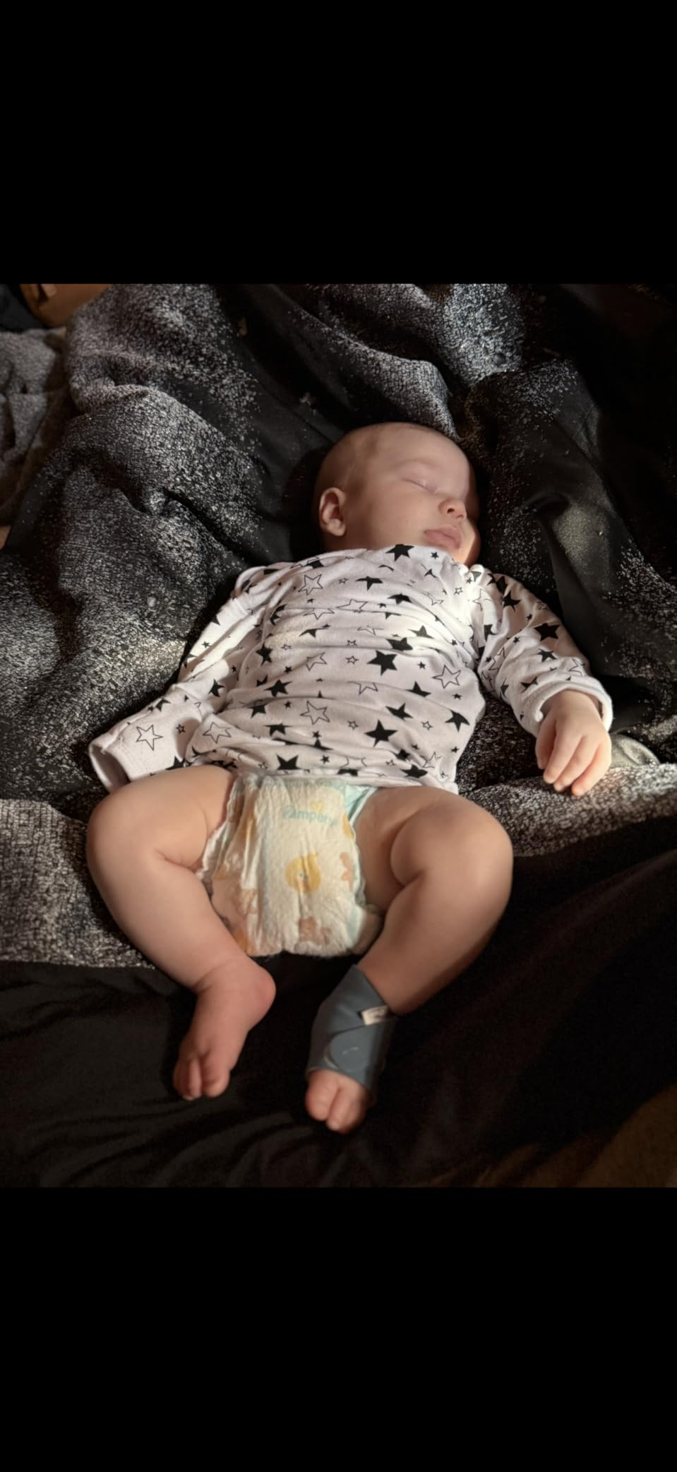 Owlet Dream Sock Smart Baby Monitor, Includes 3 Months of Owlet 360 customer photo 1
